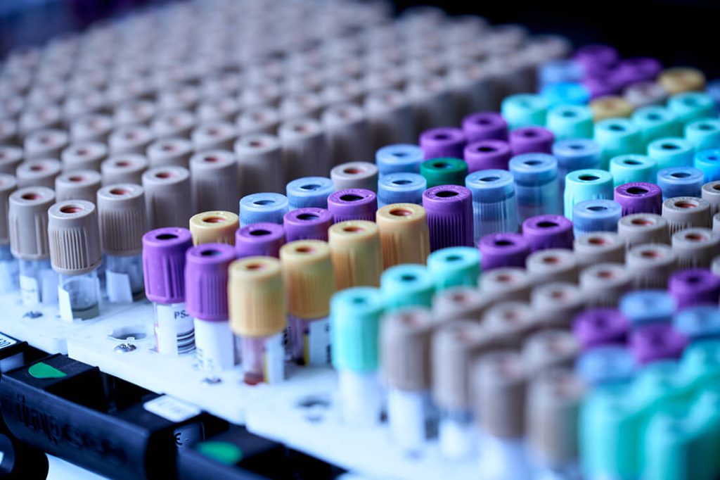Non-Hodgkin lymphoma in children and adolescentes